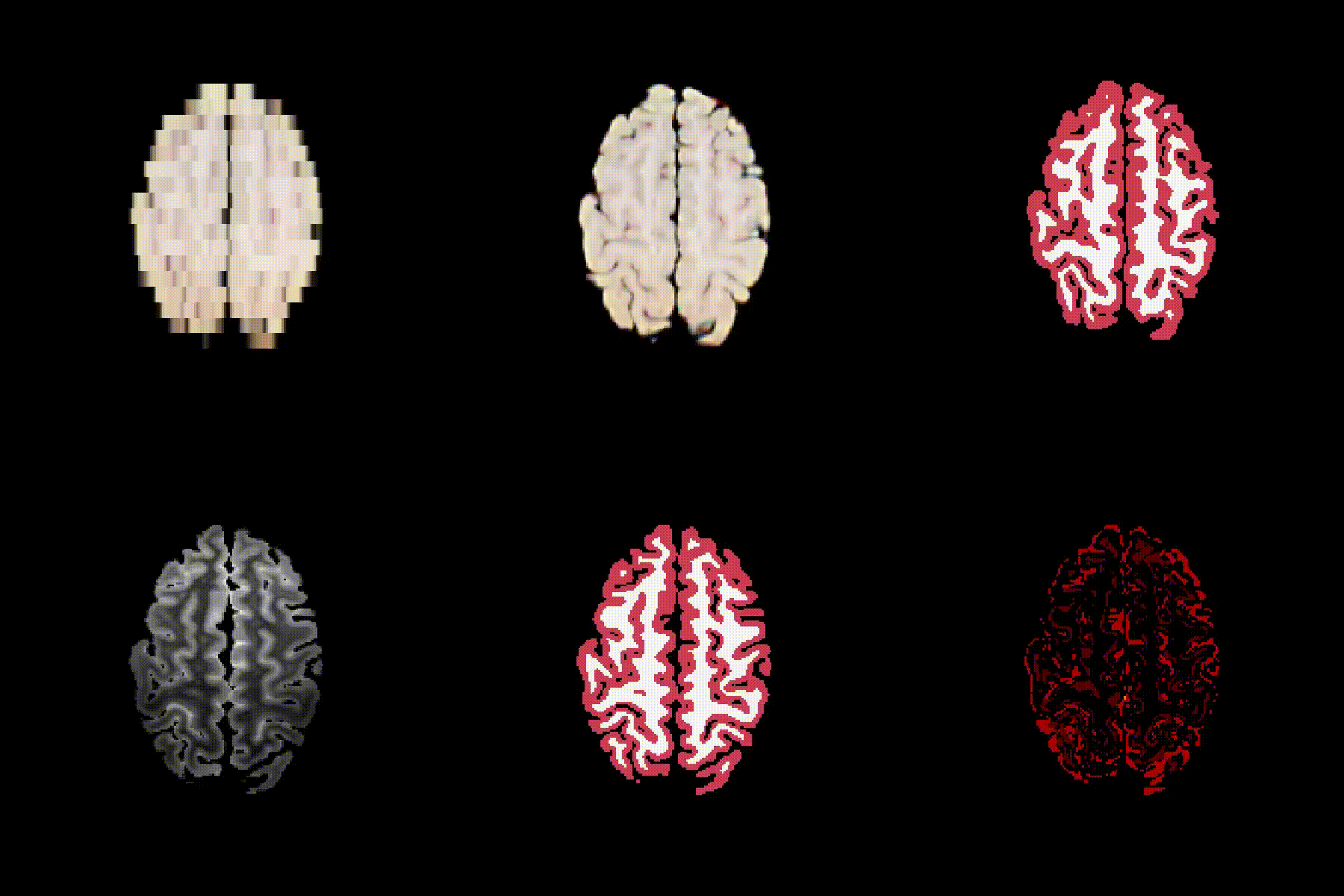 Neuropathology reconstruction demo